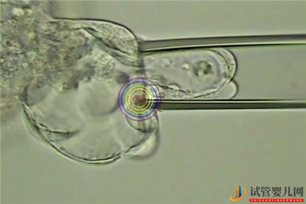 美國試管基因篩查(圖2)