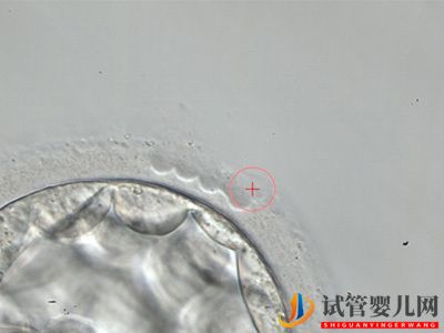 哪些食物能提高試管嬰兒備孕成功率(圖1)