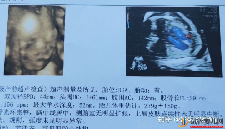 試管嬰兒網(wǎng):25歲就走上非常艱辛的試管嬰兒求子之路,感恩志愿者(圖8) 25歲就走上非常艱辛的試管嬰兒求子之路,感恩志愿者(圖4)