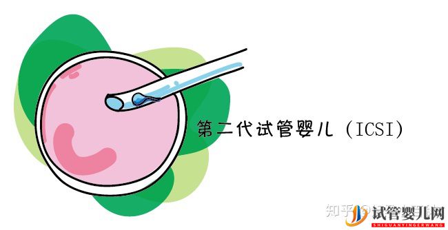 什么是三代試管嬰兒第三代試管嬰兒成功率高(圖3)