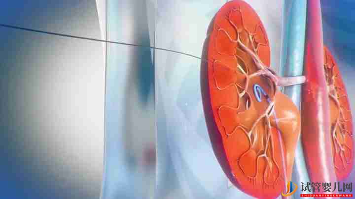 醫學三維動畫可以解決哪些問題(圖1)