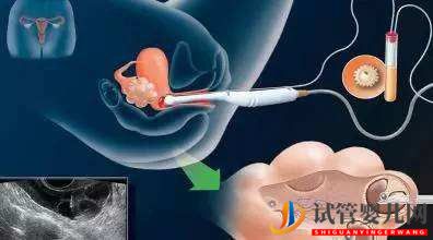 移植囊胚后可以喝蜂蜜水嗎？取卵后可以喝蜂蜜嗎？(圖1)