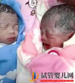 一個高齡婦女的試管之路(圖5)