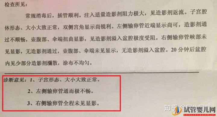 女人做了試管人就廢了其中的辛酸苦不堪言(圖1)
