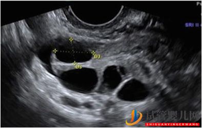 試管嬰兒網:試管嬰兒卵子質量完整指南-卵子質量完整攻略(圖7) 試管嬰兒卵子質量完整指南-卵子質量完整攻略(圖4)