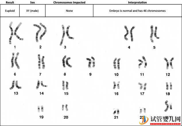 試管嬰兒網:試管嬰兒卵子質量完整指南-卵子質量完整攻略(圖16) 試管嬰兒卵子質量完整指南-卵子質量完整攻略(圖8)