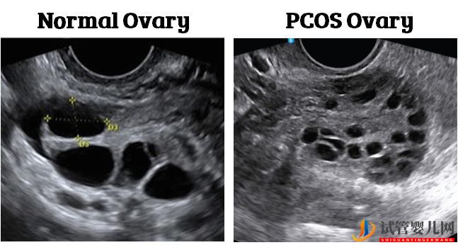 試管嬰兒網:試管嬰兒卵子質量完整指南-卵子質量完整攻略(圖26) 試管嬰兒卵子質量完整指南-卵子質量完整攻略(圖13)