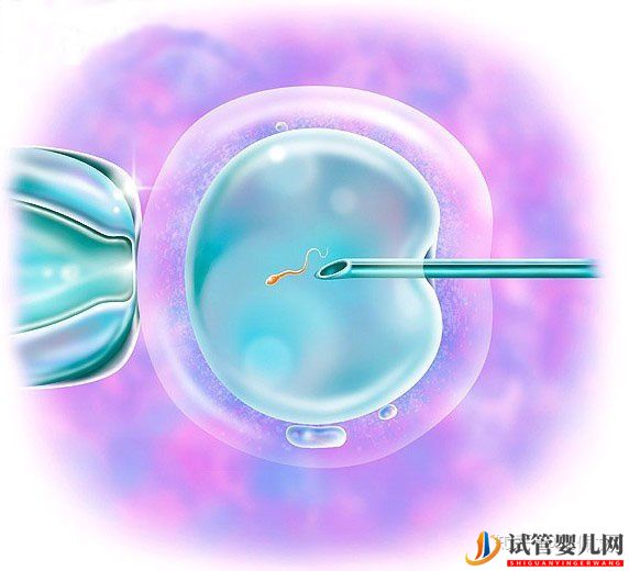 一、二、三代試管嬰兒的優(yōu)缺點(diǎn),做試管嬰兒應(yīng)該選擇(圖2)