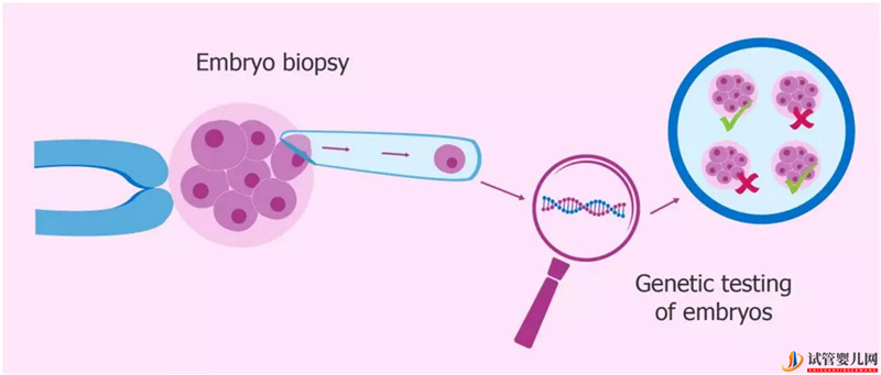 一個典型的PGD三代試管治療周期是怎樣的？(圖1)