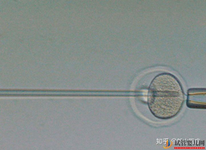 試管嬰兒幾代好一代、二代、三代先辨別清楚(圖1)