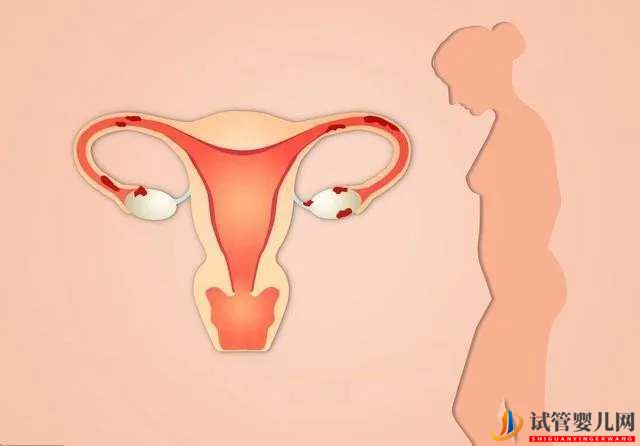 做試管嬰兒對女性身體有傷害嗎？(圖1)