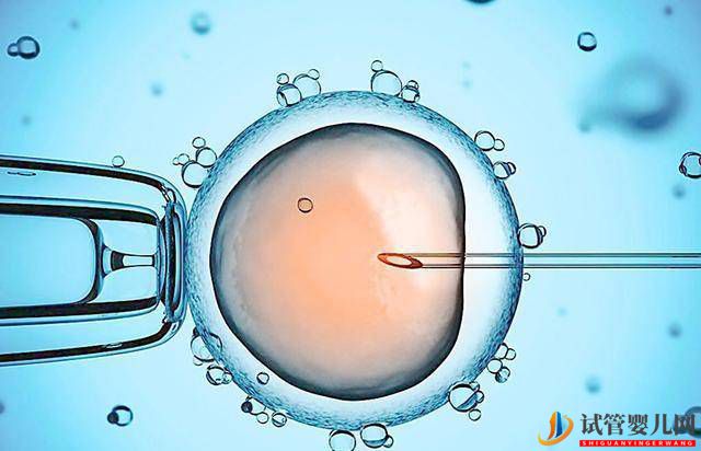 試管嬰兒網(wǎng):什么是試管嬰兒?并不是什么人都能做試管,決定前要先了解這些事(圖1) 什么是試管嬰兒?并不是什么人都能做試管,決定前要先了解這些事(圖1)
