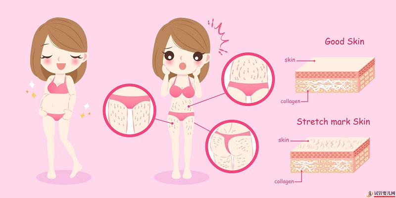 西藏1家試管嬰兒醫院排名、成功率與費用是否醫保報銷？(圖2)