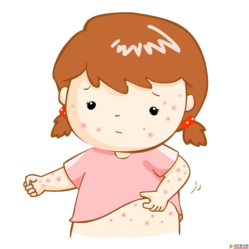 嬰兒濕疹和痤瘡有什么區別？(圖3)