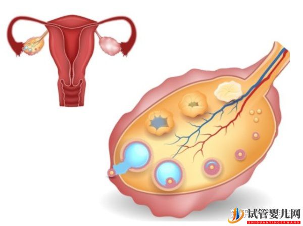 美國第三代試管嬰兒技術(shù)規(guī)避染色體異常保障后代健康(圖3)