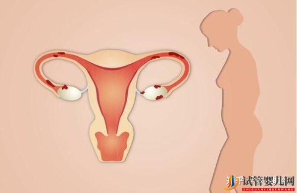 美國第三代試管嬰兒技術(shù)規(guī)避染色體異常保障后代健康(圖4)