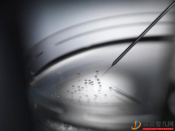 直觀分析試管嬰兒成功率高嗎(圖1)