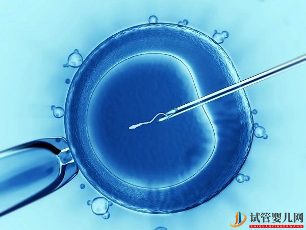 試管嬰兒技術(shù)的安全性(圖1)