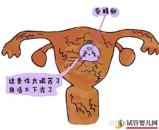 做泰國試管嬰兒要滿足哪些條件(圖2)