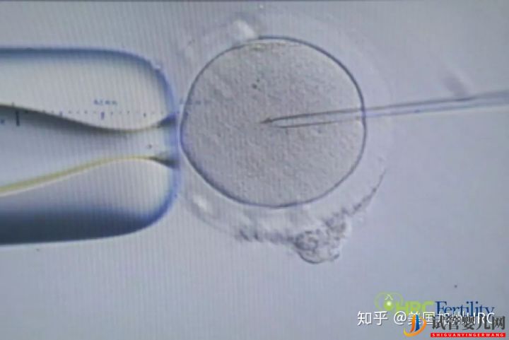 要去美國看病別怕!小C帶您全面了解美國試管嬰兒...(試管嬰兒多少錢)(圖32) 要去美國看病別怕!小C帶您全面了解美國試管嬰兒(圖7)