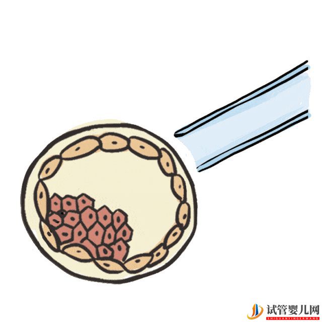 赴美試管嬰兒要經(jīng)歷哪些流程呢(圖6)