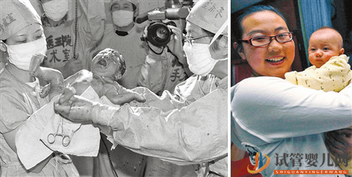 你了解試管嬰兒全過程嗎？帶你一起揭秘！(圖2)