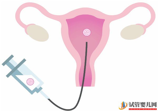 38歲高齡女性赴美試管成功率是多少(圖8)