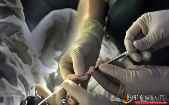 三代試管對女性身體有很大傷害嗎(圖4)