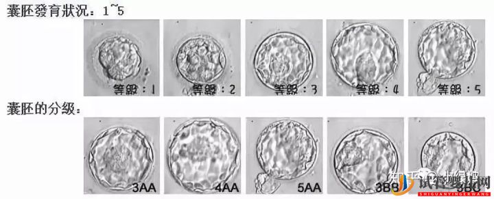 囊胚級別劃分,什么級別的囊胚成功率最高(圖5)