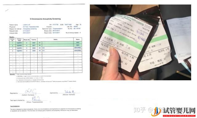 跨境醫(yī)療試管崛起,不用中介能不能去泰國試管(圖10)