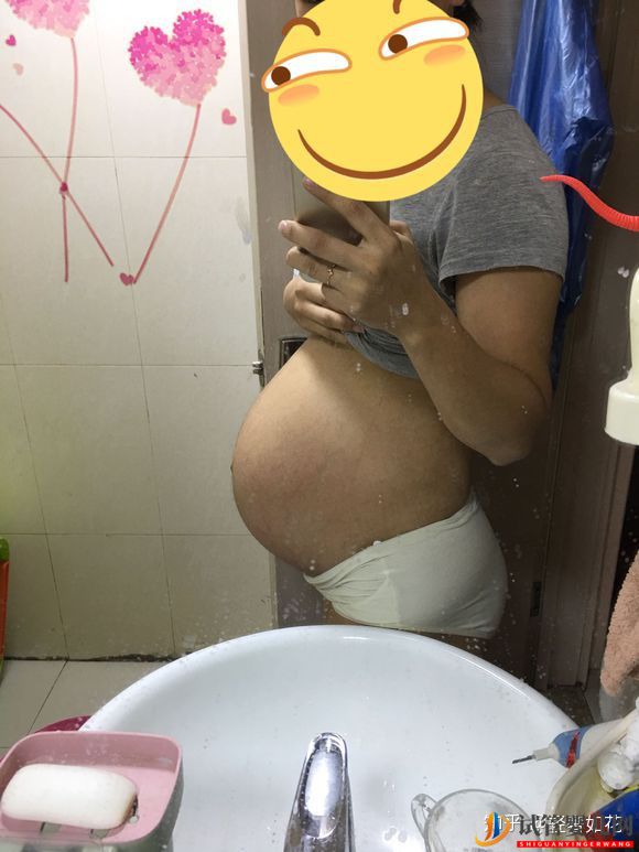 認真臉我覺得泰國試管技術真的不錯(圖3)