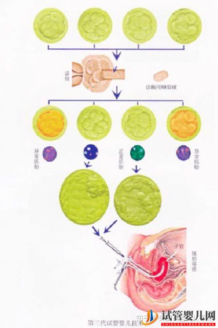 到底要不要去美國做試管嬰兒(圖1)