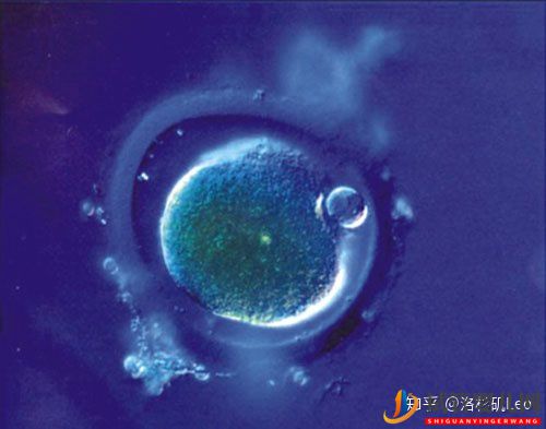 美國試管助孕可以挑選性別嗎(試管嬰兒多少錢)(圖2) 美國試管助孕可以挑選性別嗎(圖2)