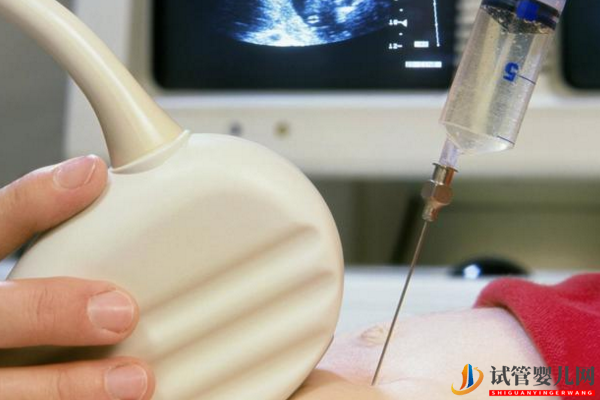 美國試管嬰兒技術分析-胎停與染色體的關系(圖1)