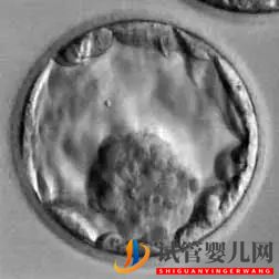 美國(guó)試管嬰兒這樣的囊胚才是極好的!(圖11)