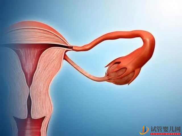 巧克力囊腫做試管移植一次就成功的概率高嗎？(圖2)