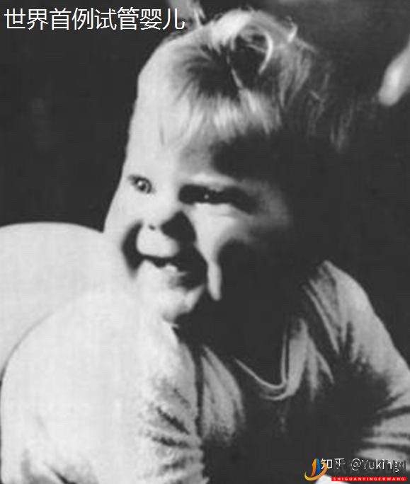 試管嬰兒科普系列一什么是一代、二代、三代試管嬰兒(圖2)