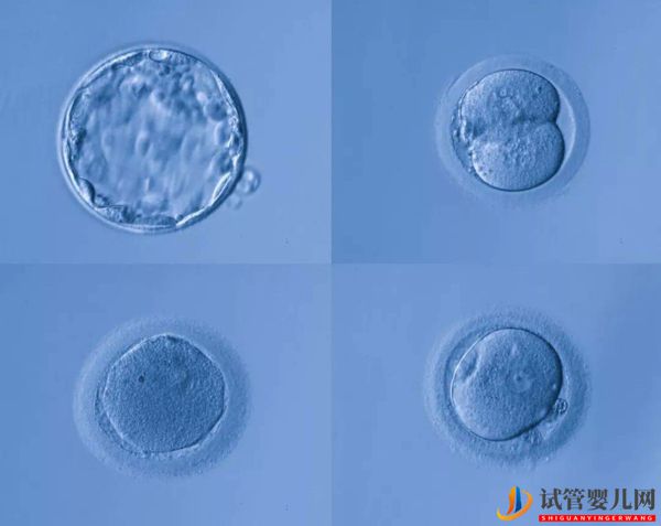 格魯吉亞試管嬰兒的詳細(xì)全流程(圖5)