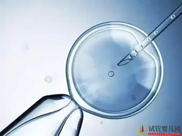 格魯吉亞試管嬰兒醫(yī)院排名(圖1) 格魯吉亞試管嬰兒醫(yī)院排名(圖1)