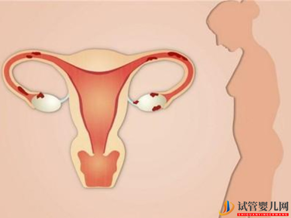 AMH值0.13卵巢早衰想懷孕怎么辦？(圖2)