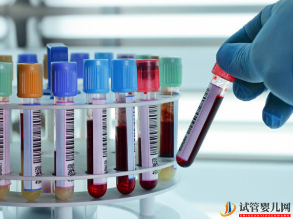 amh值0.15還沒絕經(jīng)就能取卵助孕(圖2)