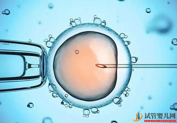 同性戀正規醫院供精、卵試管收費標準(圖1)
