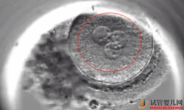 0pn胚胎移植并非不能存活，三種情況告訴你風險大不大(圖1)