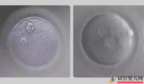 0pn胚胎移植并非不能存活，三種情況告訴你風險大不大(圖2)