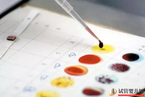 做試管檢查血型的作用在這兒，這些要求一定要記牢(圖2)