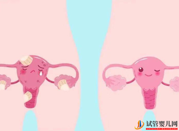 amh0.19能否自然懷孕就看還有幾個竇卵泡(圖2)