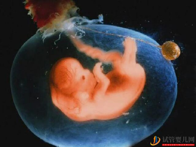試管嬰兒宮外孕早期的征兆有哪些？(圖1)