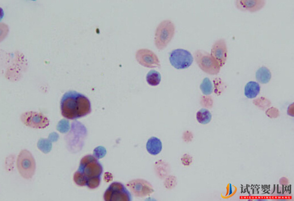 巨細胞病毒陽性不能直接做試管(圖1)