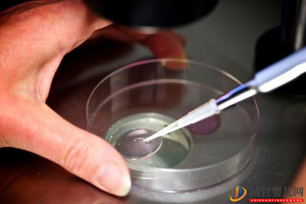 巨細胞病毒陽性不能直接做試管(圖2)