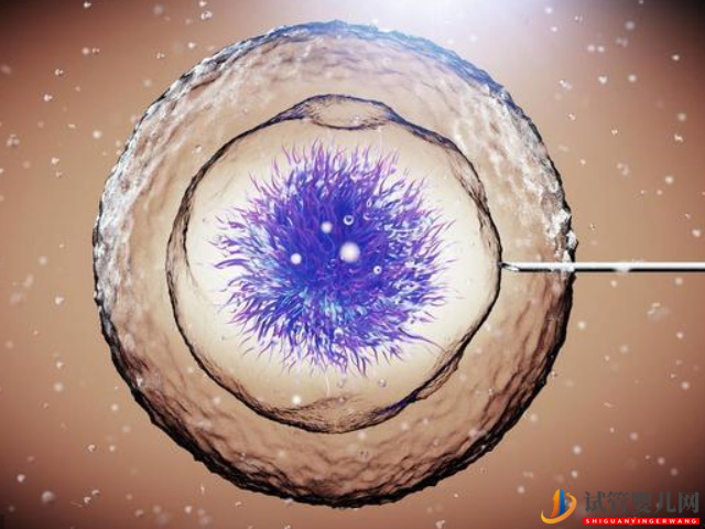 重慶婦幼保健院做試管有哪些流程？(圖1)